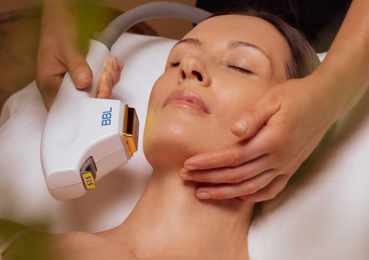 BBL Photo Facial Rejuvenation Vancouver | SKN Skincare Clinic